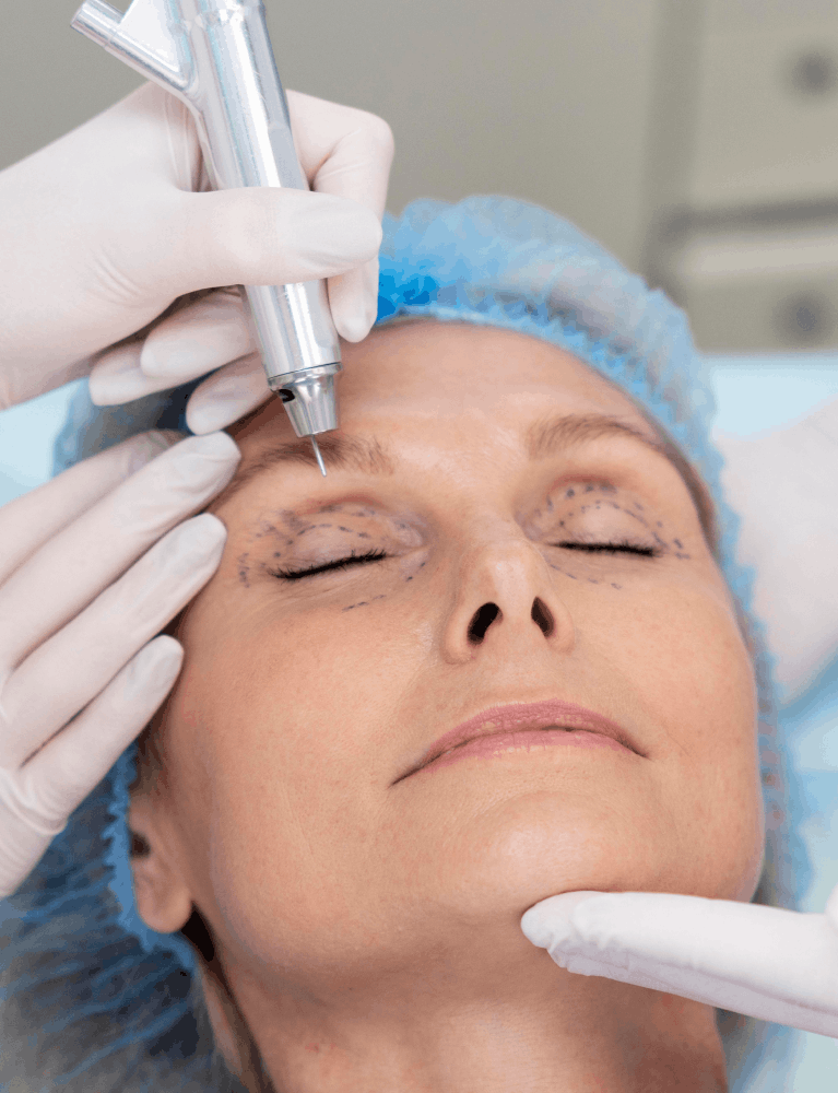 Dermatologist performing eye rejuvenation treatment on a patient to improve the appearance of the under-eye area at a skin clinic in Chennai.