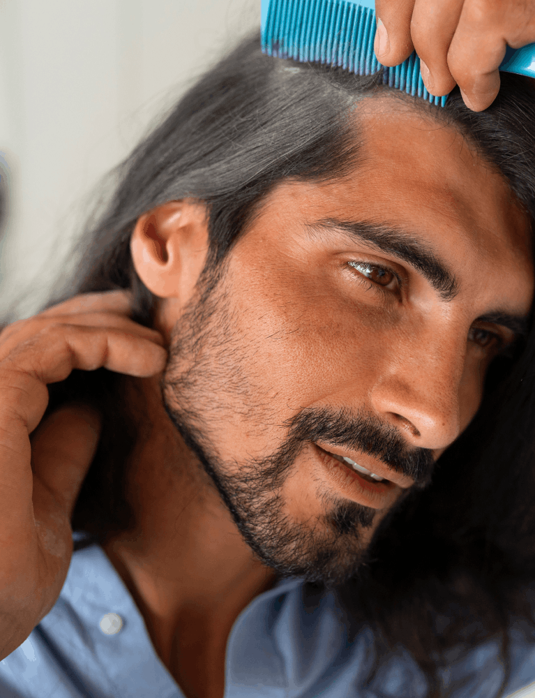Dermatologist providing treatment for patchy beard growth to improve beard density at a skin and hair clinic in Chennai.