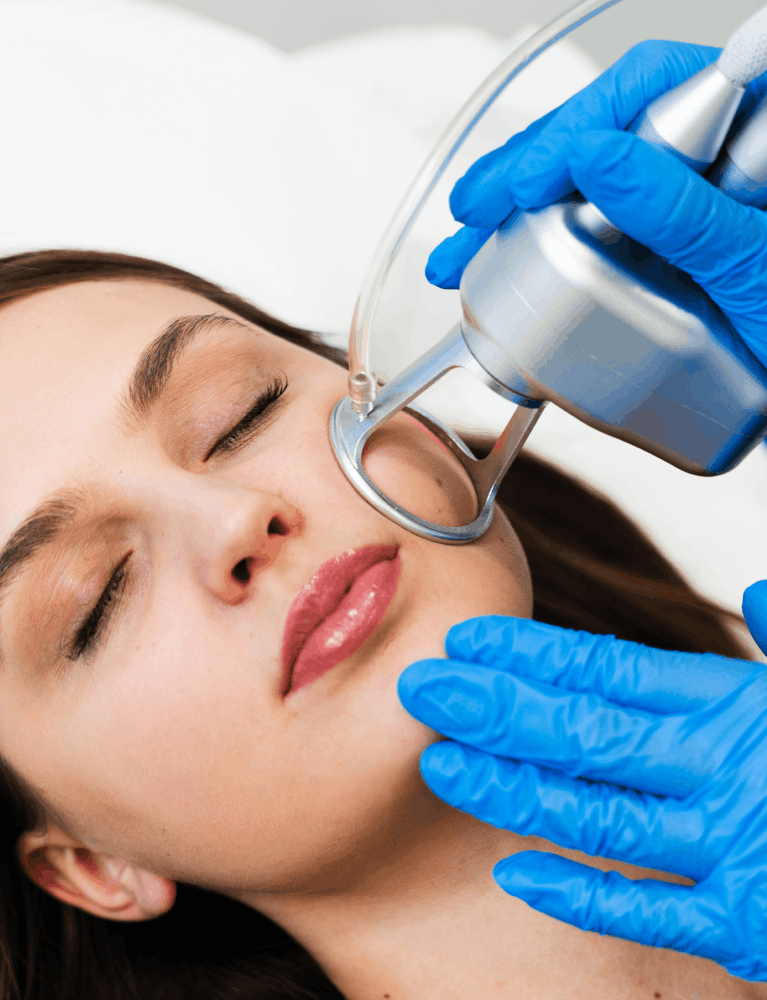 Dermatologist performing CO2 laser resurfacing treatment on a patient at a skin clinic in Chennai.