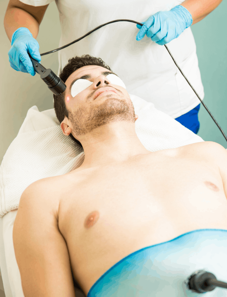 Dermatologist performing cryotherapy treatment on a patient at a skin clinic in Chennai.