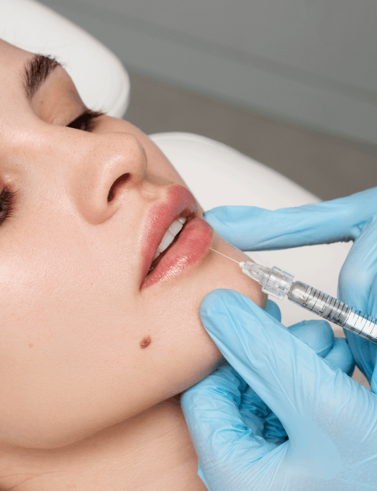 Dermatologist administering dermal filler treatment to a patient for facial rejuvenation at a skin clinic in Chennai.