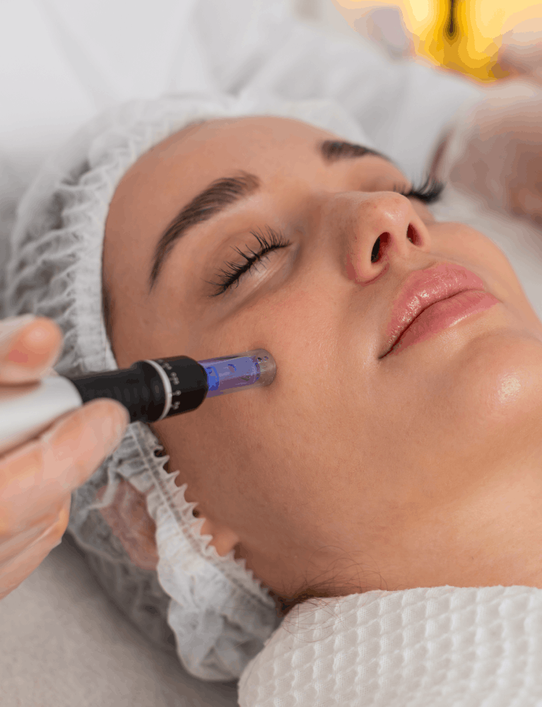 Dermatologist performing Dermapen microneedling treatment on a patient at a skin clinic in Chennai.