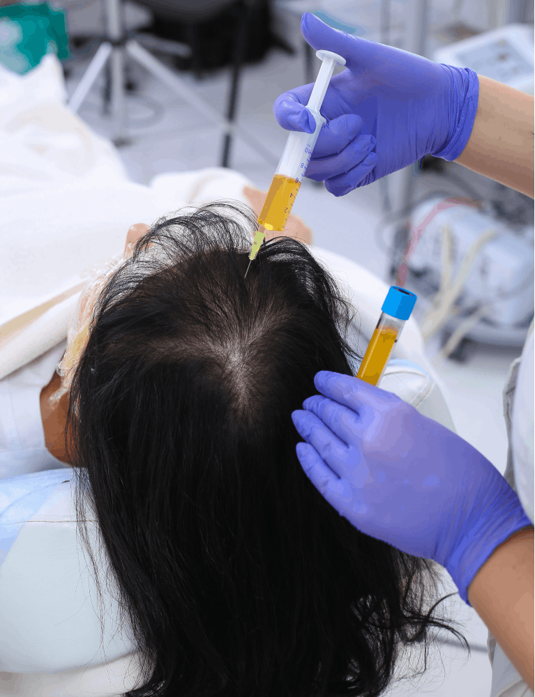- Dermatologist performing GFC hair treatment on a patient experiencing hair loss at a skin and hair clinic in Chennai.