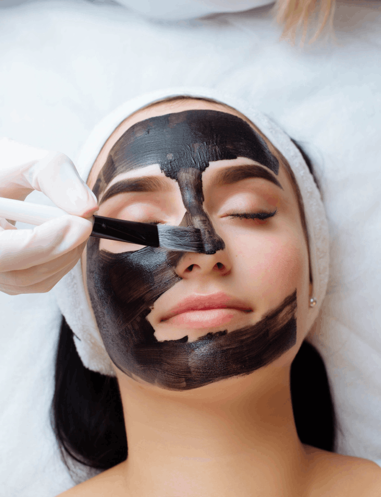 Dermatologist performing Hollywood Carbon Peel treatment on a patient at a skin clinic in Chennai.