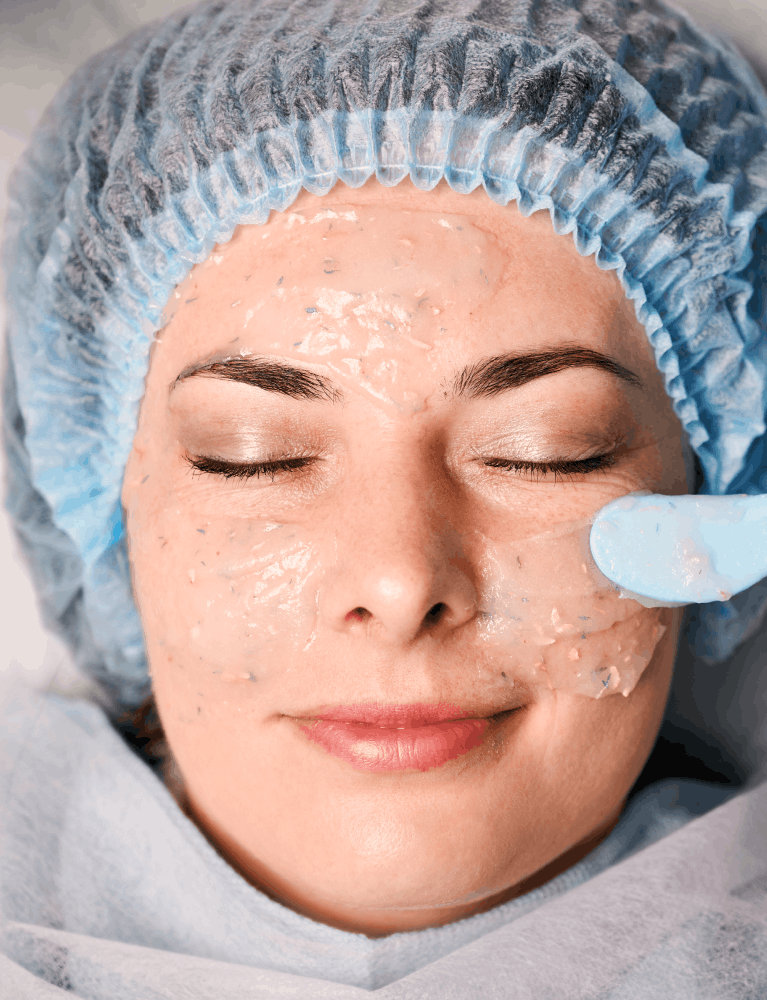 Dermatologist performing a medical grade peel treatment on a patient at a skin clinic in Chennai.